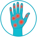 Rhumatisme et Arthrose Rhumatisme et Arthrose